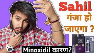 Will I Go Bald Because Of Minoxidil ? | Sahil Nagpal