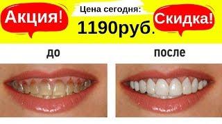 Виниры для зубов. Скидка -50% | Ссылка в описании.