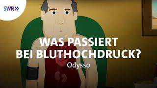 Was passiert bei Bluthochdruck? | SWR Wissen