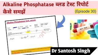 How To Read Alkaline Phosphatase Blood Test Report? Liver Test | Dr Santosh Singh (Episode 30)