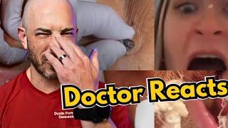 Dermatologist Reacts to Viral TikToks | Cyst Popping, Pimple Popping