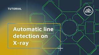 Automatic Line Detection on X-ray Views | Official 3Dsurvey Scan module Tutorial