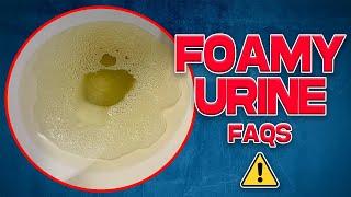 Common Questions on Foamy Urine you need to know