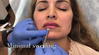 Lip Contouring - Omeed Sani MD - Sani Aesthetics