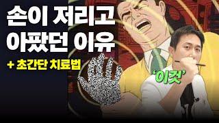 이것 안했더니 손가락관절염이 나았어요 (+방아쇠수지)