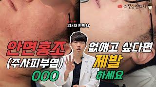 안면홍조, 주사피부염을 없애고 싶다면 제발 000 하세요