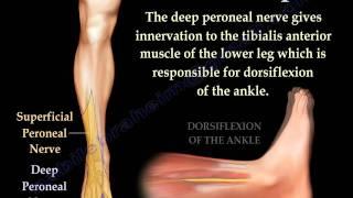 Foot Drop, Peroneal Nerve Injury - Everything You Need To Know - Dr. Nabil Ebraheim