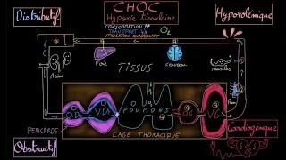 Choc - Cardiogénique - Hypovolémique - Distributif - Obstructif - Docteur Synapse