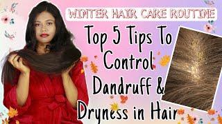 Winter Hair Care Routine | TOP 5 Tips To Control Dandruff & Dryness In Hair | Sushmita's Diaries