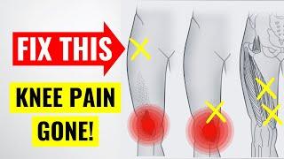 The #1 Hidden Cause of Chronic Knee Pain