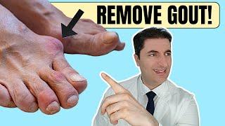 Say GOODBYE to Kidney Stones and GOUT With This Simple Tea!