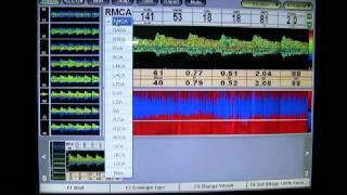 Multigon robo toc 2 md cont.swf