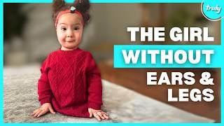 Defying The Odds Without Ears & Legs | BORN DIFFERENT