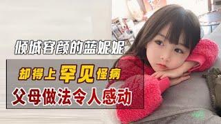 倾城容颜的蓝妮妮：因罕见病活在“无声”的世界，父母做法感动众人【网红饭圈】