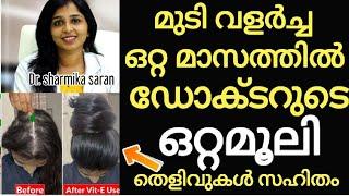 Doctor പറഞ്ഞപ്പോലെ ഇങ്ങനെ ചെയ്തുഒരിക്കലും വളരില്ല എന്ന് വിചാരിച്ച മുടി ഒരു മാസം വളർന്നത് ഇരട്ടി