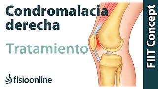 Tratamiento de la condromalacia rotuliana derecha