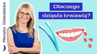 Dlaczego dziąsła krwawią? Jaka jest przyczyna? Jak leczyć?