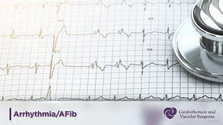 Arrhythmia | Atrial Fibrillation | Afib | Cardiothoracic Surgery | CTVS Texas