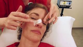 Mohs Surgery Daily Wound Care - Nose Incision | McFarland Clinic