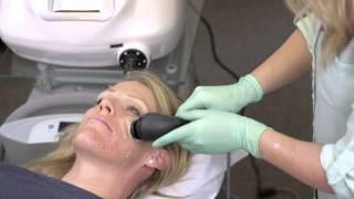 Quanta Bella RF Skin Tightening and Laxity Treatment