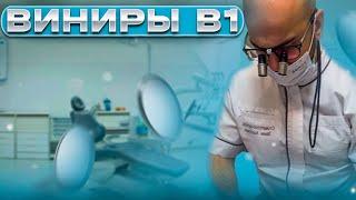 СТУДИЯ настоящих УЛЫБОК. Виниры B1.  Стоматология Сочи!