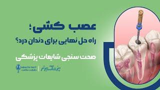 عصب کشی دندان، راه حل نهایی برای دندان درد ؟