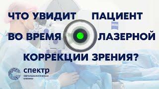 Взгляд внутрь процесса: Каким будет ваш опыт во время лазерной коррекции зрения?