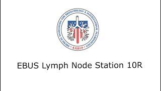 EBUS Lymph Node Station 10R