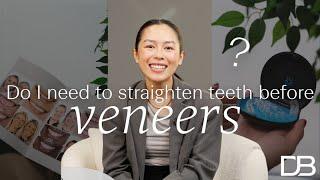 Do I need straight teeth before getting Porcelain Veneers? | Dental Boutique™