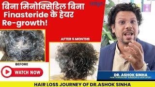 Hair Regrowth Without Minoxidil & Finasteride |Natural Hair Growth | Hair Loss | Hair Fall | Adon |