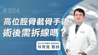 【高位脛骨截骨手術Q&A】手術後需要拆線嗎？│林育寬醫師