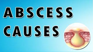 Abscess Symptoms, Treatment, and Causes