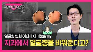 성형수술 없이 교정으로 드라마틱한 변화가 생길까??