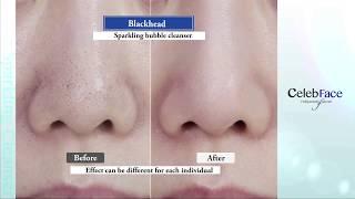 How to Remove Blackhead with CelebFace Sparkling Cleanser