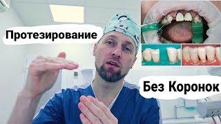 Протезирование Зубов Без Коронок