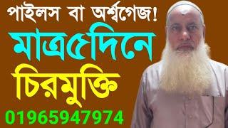 ফোন:01965947974||অর্শ গেজ বা পাইলস থেকে মাত্র ৫দিনে চিরমুক্তি||Hemorrhoids or piles in just 5 days