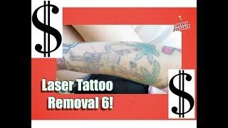 LaserAway Tattoo Removal: How Much Does It Cost? CHERRY DOLLFACE