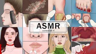 20 MINUTES Satisfying ASMR | Scalp Scaling,  Ingrown Toenail, Blackheads, Tonsil Stone Removal