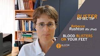 #9 Blood Blisters On Feet - Why Blood Enters The Blister - The Importance Of Pressure Management