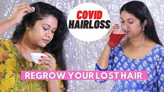 COVID-19 HAIR LOSS? Top Natural Tips To REGROW Lost Hair For Men & Women|Telogen Effluvium Hair Fall