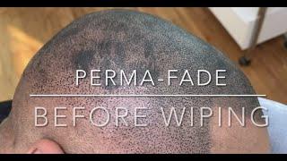 Hair Tattoo - Permanent Fade - Scalp Micropigmentation