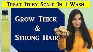 Time Tested Remedy For Itchy Scalp & Dandruff / Ginger Oil For Thick & Strong Hair Growth