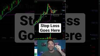 How To Manage Risk Stop Loss Trading #daytradinglive #riskmanagement #stoploss