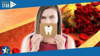 High cholesterol: The hidden warning your levels are dangerously high found in your mouth