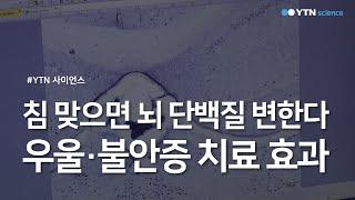 침 맞으면 뇌 단백질 변한다..."우울·불안증 치료 효과" / YTN 사이언스