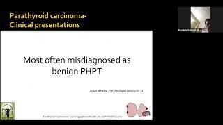 Parathyroid Carcinoma by Prof Gaurav Agarwal, Endocrine Surgery,  SGPGIMS, Lucknow