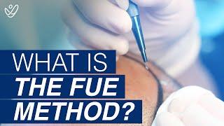 What is FUE (Follicular Unit Extraction)?