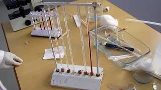 Erythrocyte sedimentation rate