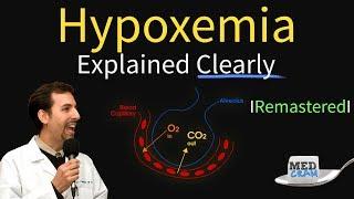 Hypoxemia - The 5 Causes & Treatment... #1 High Altitude