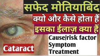 सफेद मोतियाबिंद | कारण, लक्षण व इलाज़ #cataract